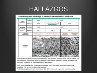 HALLAZGOS
 
