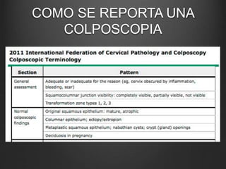COMO SE REPORTA UNA
COLPOSCOPIA
 