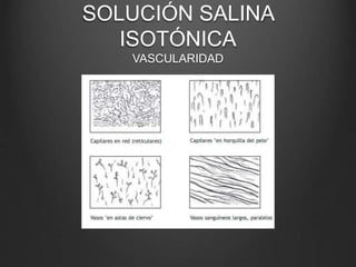 SOLUCIÓN SALINA
ISOTÓNICA
VASCULARIDAD
 