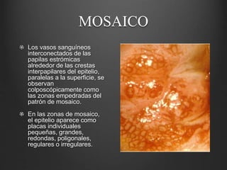 MOSAICO
Los vasos sanguíneos
interconectados de las
papilas estrómicas
alrededor de las crestas
interpapilares del epitelio,
paralelas a la superficie, se
observan
colposcópicamente como
las zonas empedradas del
patrón de mosaico.
En las zonas de mosaico,
el epitelio aparece como
placas individuales
pequeñas, grandes,
redondas, poligonales,
regulares o irregulares.
 