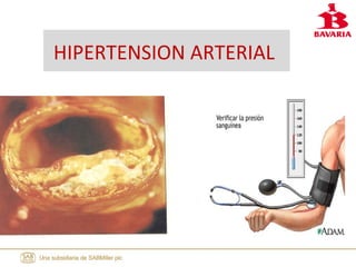 HIPERTENSION ARTERIAL
 
