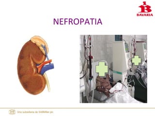 NEFROPATIA
 