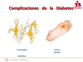 Complicaciones de la DiabetesComplicaciones de la Diabetes
Neuropatía
diabética
Ulcera
plantar
 