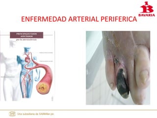 ENFERMEDAD ARTERIAL PERIFERICA
 