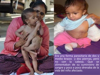 Era una forma parasitaria de dos y
medio brazos y dos piernas, pero
no con la cabeza. Que se
alimentaban de su suministro de
sangre y poco a poco drenaba de la
vida del niño afectado.
 