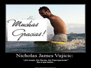 Desarrollo de Extremidades