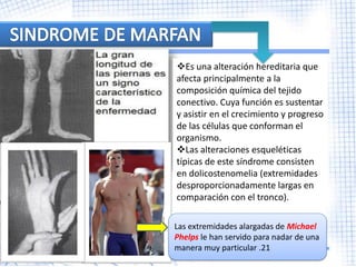 Es una alteración hereditaria que
afecta principalmente a la
composición química del tejido
conectivo. Cuya función es sustentar
y asistir en el crecimiento y progreso
de las células que conforman el
organismo.
Las alteraciones esqueléticas
típicas de este síndrome consisten
en dolicostenomelia (extremidades
desproporcionadamente largas en
comparación con el tronco).

Las extremidades alargadas de Michael
Phelps le han servido para nadar de una
manera muy particular .21
 