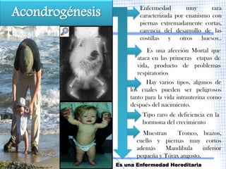 Acondrogénesis           Enfermedad        muy      rara
                         caracterizada por enanismo con
                         piernas extremadamente cortas,
                         carencia del desarrollo de las
                         costillas y otros huesos..
                            Es una afección Mortal que
                        ataca en las primeras etapas de
                        vida, producto de problemas
                        respiratorios
                            Hay varios tipos, algunos de
                     los cuales pueden ser peligrosos
                     tanto para la vida intrauterina como
                     después del nacimiento.
                          Tipo raro de deficiencia en la
                          hormona del crecimiento
                          Muestran     Tronco, brazos,
                        cuello y piernas muy cortos
                        además    Mandíbula      inferior
                        pequeña y Tórax angosto.
                 Es una Enfermedad Hereditaria
 