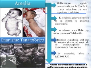 Amelia                   Malformación          congénita
                               caracterizada por la falta de 1
                               o mas miembros ya sean
                               superiores o inferiores.

                                 Es originada generalmente en
                              la 4ta semana de gestación
                              embrionaria

                                 se observa a un Bebe cuya
                            madre consumió Talidomida.


Enanismo Tanatofórico            Displasia esquelética letal que
                              se engloba dentro del grupo de
                              las      condrodisplasias      con
                              transparencia ósea normal

                                Es esporádica,       afecta      a
                              1/17.000 R.N.


                          Ambas enfermedades conllevan a
                        malformaciones en ambos miembros
 