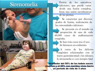 Fusión de los miembros
Sirenomelia              inferiores, que puede variar
                         desde una fusión completa,
                         hasta una unión membranosa
                         de las piernas.
                             Se caracteriza por diversos
                      grados de fusión, malrotación de
                      las extremidades inferiores
                             Se presenta en el mundo en
                     una proporción de uno de cada
                     60,000 casos de malformación
                     congénita.
                           Se han visto casos tras el uso
                           de fármacos en embarazo .

                           A causa de los defectos
                       congénitos relacionados con el
                       tracto gastrointestinal y los riñones,
                       la sirenomelia es casi siempre fatal
                Alrededor del 50% de los bebés nacen
              muertos y el 50% son nacidos vivos hasta
                    un periodo de vida de 3 años
 