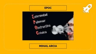 MIHAIL ARCIA
EPOC
 