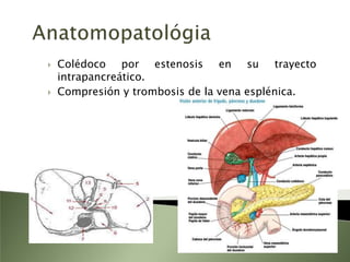 Pancreatitis crónicaPancreatitis agudaPancreatitis aguda recurrentePancreatitis crónica de recaídasPancreatitis crónica persistente. Se observa que los enfermos tienen episodios diarios de dolor constante
