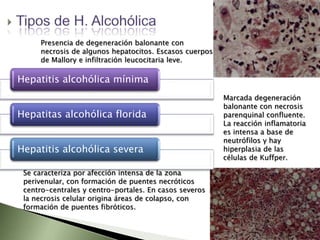 Las lesiones de células hepáticas suelen originar aumentos de las concentraciones circulantes de aminoácidos.