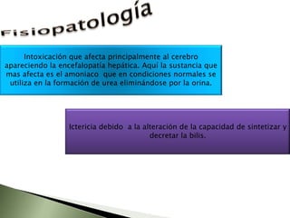 histologiaHistológicamente se ve la presencia de un material más rojizo que se dispone alrededor del núcleo, los llamados cuerpos de Mallory, característicos pero no patognomónicos de hepatitis alcohólica. (debido a que pueden presentarse en otras patologías como la diabetes). Además se   puede pesquisar balonamiento, necrosis    lítica y se podrían encontrar    también pequeñas zonas    de fibrosis.