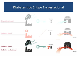 Diabetes tipo 1, tipo 2 y gestacional
 