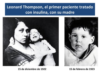 15 de diciembre de 1922 15 de febrero de 1923
Leonard Thompson, el primer paciente tratado
con insulina, con su madre
 