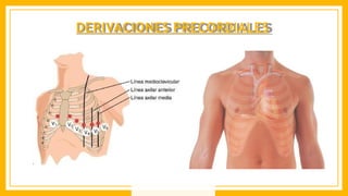DERIVACIONES PRECORDIALES
 