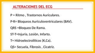 ALTERACIONES DEL ECG
P = Ritmo , Trastornos Auriculares.
P-R= Bloqueos Auriculoventriculares (BAV).
QRS =Bloqueo De Rama.
ST-T=Injuria, Lesión, Infarto.
T= Hidroelectrolíticos (K,Ca).
QS= Secuela, Fibrosis , Cicatriz.
 