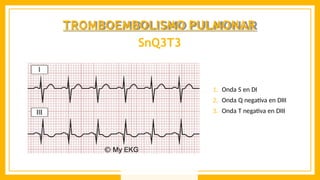 1. Onda S en DI
2. Onda Q negativa en DIII
3. Onda T negativa en DIII
TROMBOEMBOLISMO PULMONAR
SnQ3T3
 