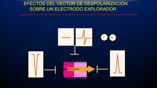 EFECTOS DEL VECTOR DE DESPOLARIZACIÓN
SOBRE UN ELECTRODO EXPLORADOR
Despolarizaciòn
- +
 