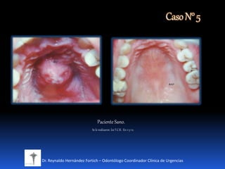 CasoN°5
Dr. Reynaldo Hernández Fortich – Odontólogo Coordinador Clínica de Urgencias
Paciente Sano.
Se le realizaron los T.C.R. En 11 y 12.
 