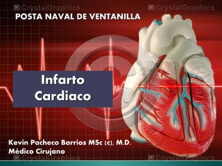 POSTA NAVAL DE VENTANILLA
Infarto
Cardiaco
Kevin Pacheco Barrios MSc (c), M.D.
Médico Cirujano
 