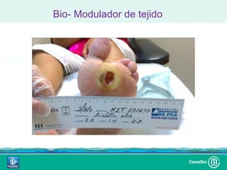 Bio- Modulador de tejido
 