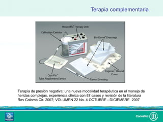 Terapia complementaria




Terapia de presión negativa: una nueva modalidad terapéutica en el manejo de
heridas complejas, experiencia clínica con 87 casos y revisión de la literatura
Rev Colomb Cir. 2007; VOLUMEN 22 No. 4 OCTUBRE - DICIEMBRE 2007
 