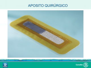 APOSITO QUIRÚRGICO
 