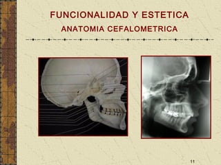 11
FUNCIONALIDAD Y ESTETICA
ANATOMIA CEFALOMETRICA
 