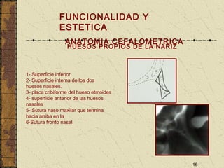 16
HUESOS PROPIOS DE LA NARIZ
FUNCIONALIDAD Y
ESTETICA
ANATOMIA CEFALOMETRICA
1- Superficie inferior
2- Superficie interna de los dos
huesos nasales.
3- placa cribiforme del hueso etmoides
4- superficie anterior de las huesos
nasales
5- Sutura naso maxilar que termina
hacia arriba en la
6-Sutura fronto nasal
 