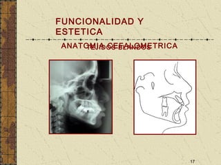 17
TEJIDOS BLANDOS
FUNCIONALIDAD Y
ESTETICA
ANATOMIA CEFALOMETRICA
 