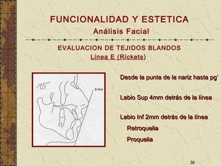 36
FUNCIONALIDAD Y ESTETICA
Análisis Facial
EVALUACION DE TEJIDOS BLANDOS
Linea E (Rickets)
Desde la punta de la nariz hasta pg’Desde la punta de la nariz hasta pg’
Labio Sup 4mm detrás de la líneaLabio Sup 4mm detrás de la línea
Labio Inf 2mm detrás de la líneaLabio Inf 2mm detrás de la línea
RetroqueliaRetroquelia
ProqueliaProquelia
 