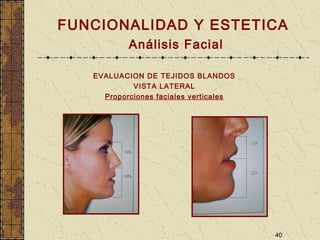 40
FUNCIONALIDAD Y ESTETICA
Análisis Facial
EVALUACION DE TEJIDOS BLANDOS
VISTA LATERAL
Proporciones faciales verticales
 