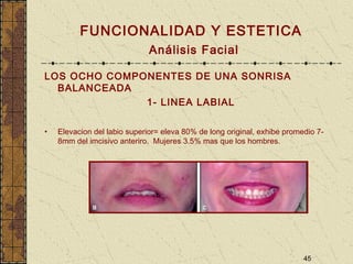 45
FUNCIONALIDAD Y ESTETICA
Análisis Facial
LOS OCHO COMPONENTES DE UNA SONRISA
BALANCEADA
1- LINEA LABIAL
• Elevacion del labio superior= eleva 80% de long original, exhibe promedio 7-
8mm del imcisivo anteriro. Mujeres 3.5% mas que los hombres.
 