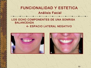 53
FUNCIONALIDAD Y ESTETICA
Análisis Facial
LOS OCHO COMPONENTES DE UNA SONRISA
BALANCEADA
4- ESPACIO LATERAL NEGATIVO
 
