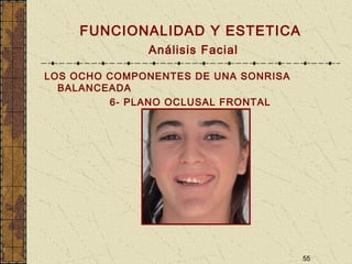 55
FUNCIONALIDAD Y ESTETICA
Análisis Facial
LOS OCHO COMPONENTES DE UNA SONRISA
BALANCEADA
6- PLANO OCLUSAL FRONTAL
 