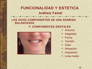 56
FUNCIONALIDAD Y ESTETICA
Análisis Facial
LOS OCHO COMPONENTES DE UNA SONRISA
BALANCEADA
7- COMPONENTES DENTALES
Armonía
Integridad
Forma
Tamaño
Color
Alineación
Angulación
Línea media
 