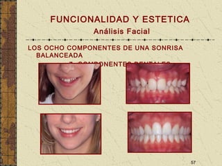 57
FUNCIONALIDAD Y ESTETICA
Análisis Facial
LOS OCHO COMPONENTES DE UNA SONRISA
BALANCEADA
7- COMPONENTES DENTALES
 