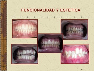 9
FUNCIONALIDAD Y ESTETICA
 