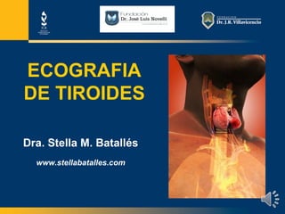 batalless@icronline.com
ECOGRAFIA
DE TIROIDES
Dra. Stella M. Batallés
www.stellabatalles.com
 