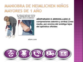 AÑOPARADO O ARRODILLADO (5
compresiones adentro y arriba) Línea
media, por encima del ombligo lejos
del apéndice xifoides
 