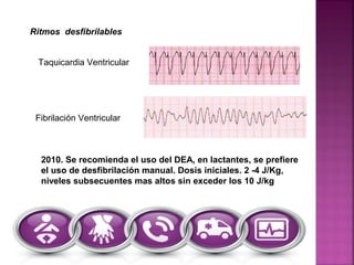 Ritmos desfibrilables
2010. Se recomienda el uso del DEA, en lactantes, se prefiere
el uso de desfibrilación manual. Dosis iniciales. 2 -4 J/Kg,
niveles subsecuentes mas altos sin exceder los 10 J/kg
Taquicardia Ventricular
Fibrilación Ventricular
 