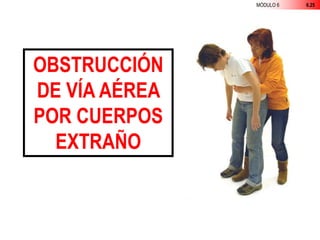 MÓDULO 6 6.25
OBSTRUCCIÓN
DE VÍA AÉREA
POR CUERPOS
EXTRAÑO
 
