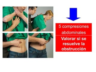5 compresiones
abdominales
Valorar si se
resuelve la
obstrucción
 