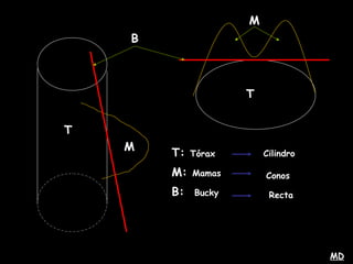 T
T
M
M
B
T: Tórax
M: Mamas
B: Bucky
Cilindro
Conos
Recta
MD
 