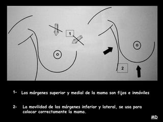 1
2
1- Los márgenes superior y medial de la mama son fijos e inmóviles
2- La movilidad de los márgenes inferior y lateral, se usa para
colocar correctamente la mama.
MD
 