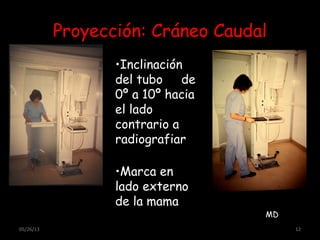 05/26/13 12
Proyección: Cráneo Caudal
•Inclinación
del tubo de
0º a 10º hacia
el lado
contrario a
radiografiar
•Marca en
lado externo
de la mama
MD
MD
 