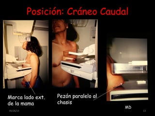 Posición: Cráneo Caudal
Marca lado ext.
de la mama
Pezón paralelo al
chasis
05/26/13 13
MD
 