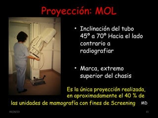 05/26/13 15
Proyección: MOL
• Inclinación del tubo
45º a 70º Hacia el lado
contrario a
radiografiar
• Marca, extremo
superior del chasis
misma.
Es la única proyección realizada,
en aproximadamente el 40 % de
las unidades de mamografía con fines de Screening MD
 